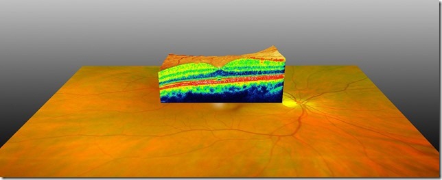 Optische Kohärenztomographie OCT